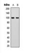 Aconitase 1 antibody, orb393196, Biorbyt, Western Blot image 
