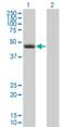 Polyribonucleotide 5 -hydroxyl-kinase Clp1 antibody, H00010978-M01, Novus Biologicals, Western Blot image 