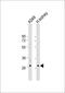 Poly(A) Binding Protein Nuclear 1 Like, Cytoplasmic antibody, 56-113, ProSci, Western Blot image 
