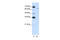 Cytoplasmic polyadenylation element-binding protein 2 antibody, ARP41186_P050, Aviva Systems Biology, Western Blot image 