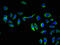 Gamma-Glutamyltransferase 1 antibody, orb400592, Biorbyt, Immunocytochemistry image 