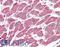 Carnitine Palmitoyltransferase 1A antibody, LS-B3015, Lifespan Biosciences, Immunohistochemistry paraffin image 