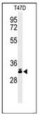 Dickkopf WNT Signaling Pathway Inhibitor 1 antibody, AP51269PU-N, Origene, Western Blot image 