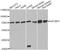 Insulin Like Growth Factor 2 MRNA Binding Protein 1 antibody, A1517, ABclonal Technology, Western Blot image 
