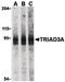 Ring Finger Protein 216 antibody, PA5-20079, Invitrogen Antibodies, Western Blot image 