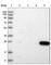 Carboxymethylenebutenolidase Homolog antibody, HPA036571, Atlas Antibodies, Western Blot image 