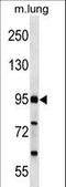 FCH Domain Only 2 antibody, LS-C159638, Lifespan Biosciences, Western Blot image 