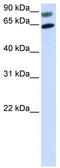 Segment polarity protein dishevelled homolog DVL-2 antibody, TA329901, Origene, Western Blot image 
