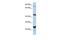 Magnesium Transporter MRS2 antibody, GTX46048, GeneTex, Western Blot image 
