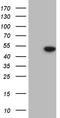 Histone deacetylase 8 antibody, TA809654S, Origene, Western Blot image 