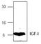 Insulin Like Growth Factor 1 antibody, TA319033, Origene, Western Blot image 