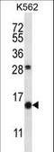 Secretoglobin family 1D member 2 antibody, LS-C162894, Lifespan Biosciences, Western Blot image 