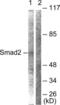 SMAD2 antibody, LS-B10160, Lifespan Biosciences, Western Blot image 
