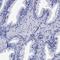 Myosin Binding Protein C, Cardiac antibody, HPA040147, Atlas Antibodies, Immunohistochemistry frozen image 