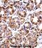 DNA Polymerase Iota antibody, abx028115, Abbexa, Immunohistochemistry frozen image 