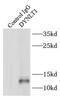 Dynein light chain Tctex-type 1 antibody, FNab02590, FineTest, Immunoprecipitation image 