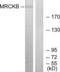 CDC42 Binding Protein Kinase Beta antibody, LS-B8531, Lifespan Biosciences, Western Blot image 