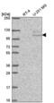 TSR1 Ribosome Maturation Factor antibody, NBP2-58300, Novus Biologicals, Western Blot image 