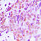 X-Ray Repair Cross Complementing 1 antibody, LS-C353008, Lifespan Biosciences, Immunohistochemistry paraffin image 