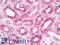 PTC1 antibody, LS-B9983, Lifespan Biosciences, Immunohistochemistry paraffin image 