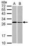 STX3 antibody, PA5-31208, Invitrogen Antibodies, Western Blot image 