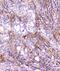 Fc Fragment Of IgG Receptor IIa antibody, A01450-1, Boster Biological Technology, Immunohistochemistry paraffin image 