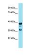 Regulator Of G Protein Signaling 7 Binding Protein antibody, orb326941, Biorbyt, Western Blot image 