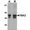 Y-Box Binding Protein 2 antibody, MBS151504, MyBioSource, Western Blot image 