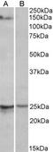 RNA Binding Motif Protein 20 antibody, PA5-19403, Invitrogen Antibodies, Western Blot image 