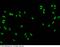 Estrogen Receptor 1 antibody, 100386-T10, Sino Biological, Immunohistochemistry paraffin image 