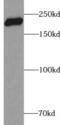 Zinc Finger E-Box Binding Homeobox 1 antibody, FNab09620, FineTest, Western Blot image 