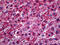 Hypoxia Up-Regulated 1 antibody, 51-739, ProSci, Immunohistochemistry paraffin image 