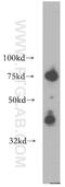 Carbonic Anhydrase 12 antibody, 15180-1-AP, Proteintech Group, Western Blot image 