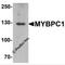 Myosin Binding Protein C, Slow Type antibody, 6679, ProSci Inc, Western Blot image 