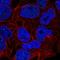 Regulator Of Telomere Elongation Helicase 1 antibody, HPA067329, Atlas Antibodies, Immunocytochemistry image 