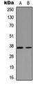 Nei Like DNA Glycosylase 2 antibody, orb234919, Biorbyt, Western Blot image 