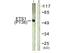 ETS Proto-Oncogene 1, Transcription Factor antibody, PA5-37572, Invitrogen Antibodies, Western Blot image 