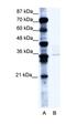BMI1 Proto-Oncogene, Polycomb Ring Finger antibody, orb324520, Biorbyt, Western Blot image 