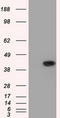 Sterol O-acyltransferase 2 antibody, CF501223, Origene, Western Blot image 