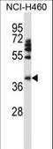 Forkhead box protein D1 antibody, LS-B9155, Lifespan Biosciences, Western Blot image 