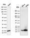 Galectin 1 antibody, AE00283, Aeonian Biotech, Western Blot image 