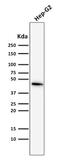 Keratin 19 antibody, GTX34649, GeneTex, Western Blot image 