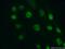 Tumor Protein P63 antibody, 12143-1-AP, Proteintech Group, Immunofluorescence image 