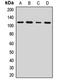 FA Core Complex Associated Protein 100 antibody, orb412799, Biorbyt, Western Blot image 