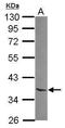 N-Terminal Asparagine Amidase antibody, GTX119378, GeneTex, Western Blot image 