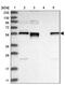 Endoplasmic Reticulum Oxidoreductase 1 Beta antibody, PA5-55764, Invitrogen Antibodies, Western Blot image 