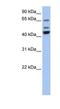 Vacuolar Protein Sorting 4 Homolog A antibody, NBP1-55140, Novus Biologicals, Western Blot image 