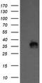Kinesin Family Member 25 antibody, TA505425, Origene, Western Blot image 