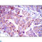 HsMAD2 antibody, LS-C812769, Lifespan Biosciences, Immunohistochemistry paraffin image 