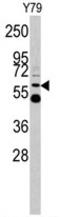 UDP-glucuronosyltransferase 2B17 antibody, AP17820PU-N, Origene, Western Blot image 
